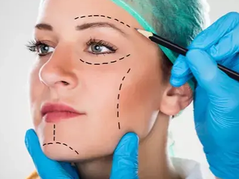 عوارض لیفت صورت؛ کدام طبیعی است کدام خطرناک؟