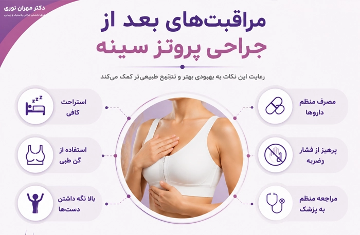 دوره نقاهت بعد از جراحی پروتز سینه