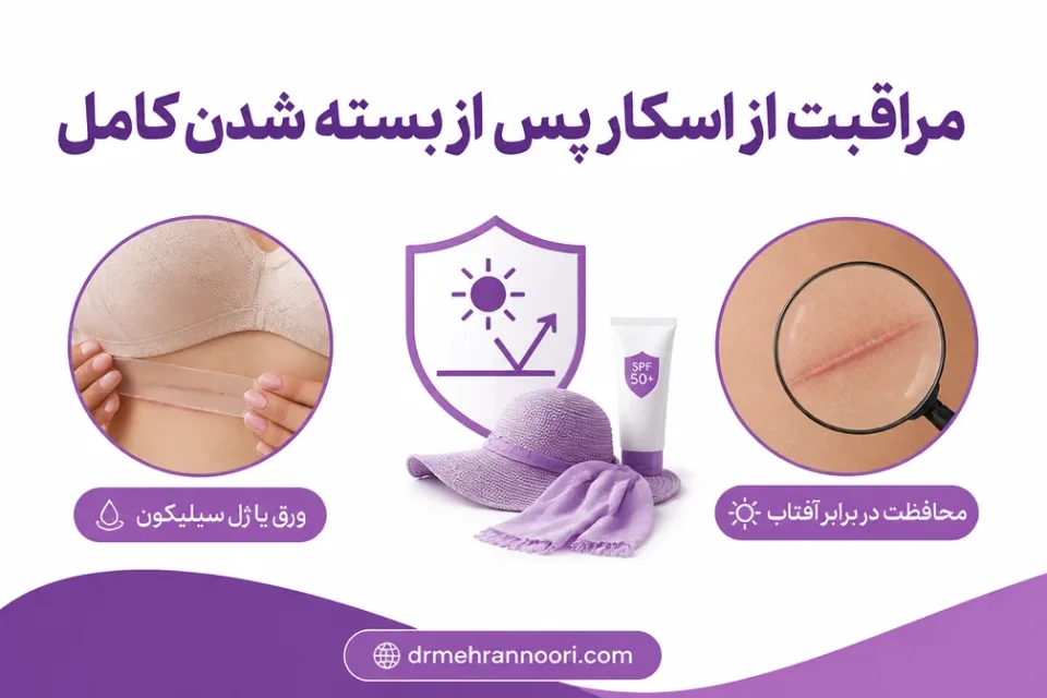 نمای توضیحی درباره مراقبت از اسکار پس از بسته شدن کامل زخم