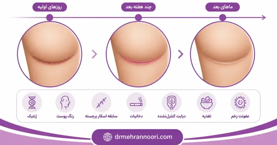 جای بخیه بعد عمل پروتز سینه