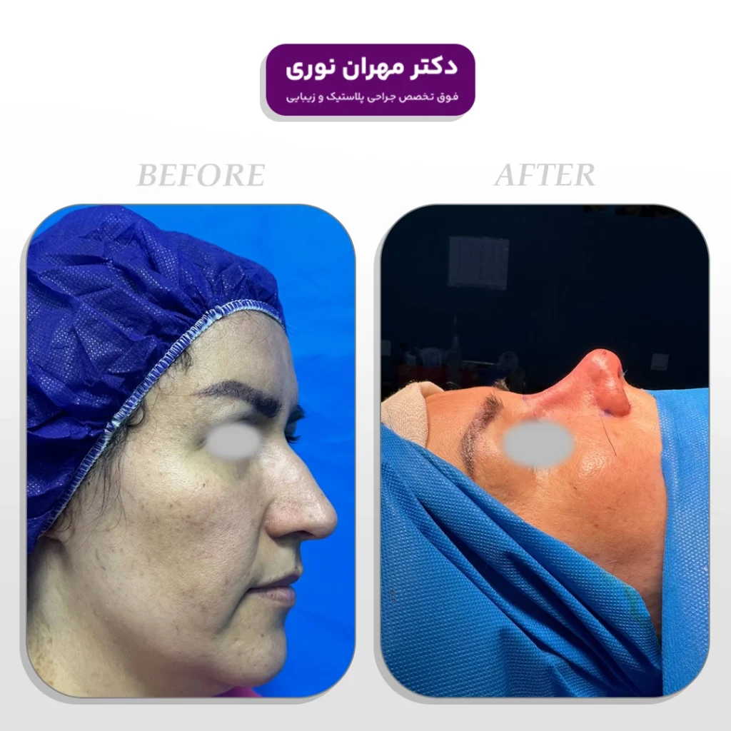 نمونه کار عمل بینی دکتر نوری