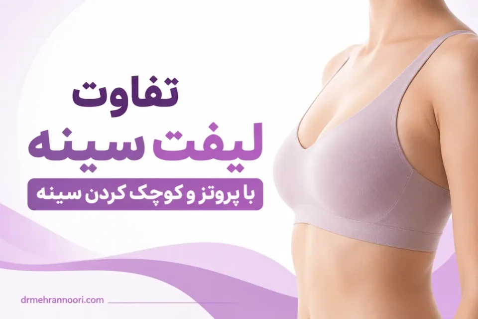 تفاوت لیفت سینه با پروتز و کوچک کردن سینه — مقایسه شماتیک لیفت سینه، پروتز سینه و لیفت همراه پروتز
