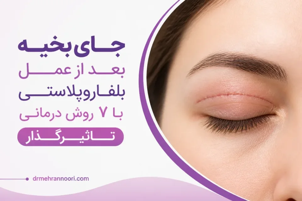 نمای توضیحی درباره چه زمانی جای بخیه نیاز به بررسی فوری دارد